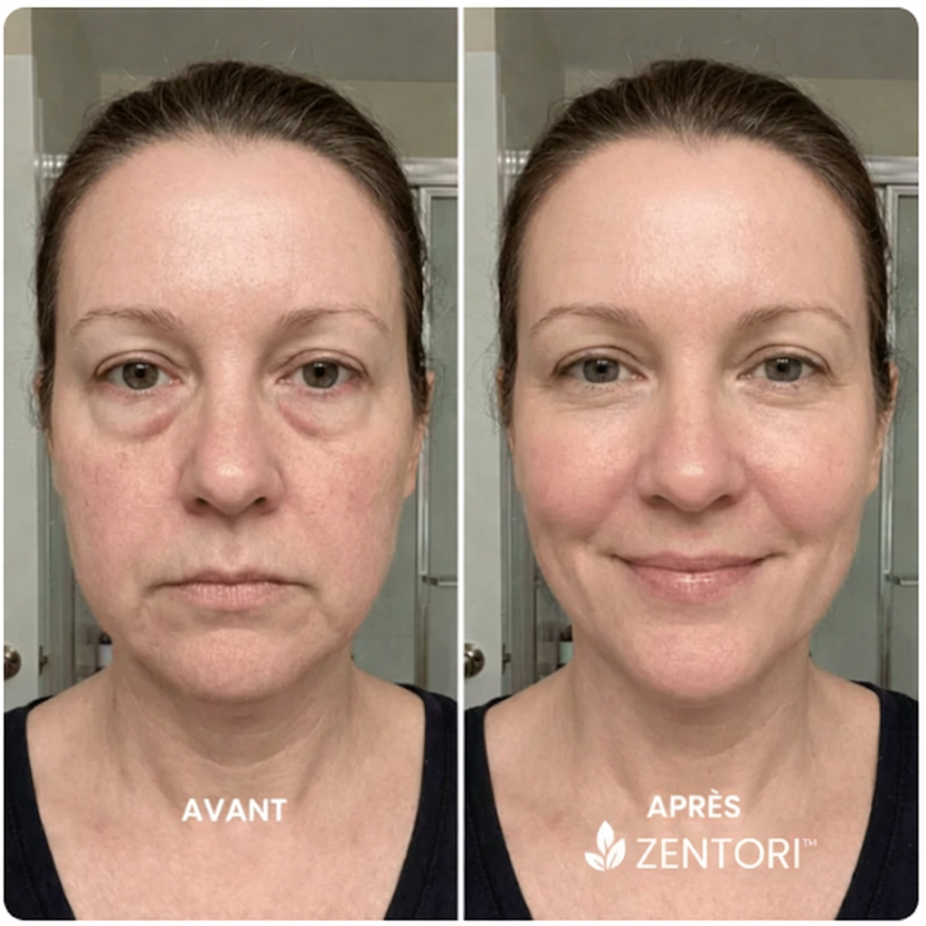 ZENTORI - Brosse de Drainage Lymphatique Visage